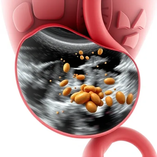 담낭슬러지 증상, 일반 소화불량과 구별하는 자가 체크리스트
